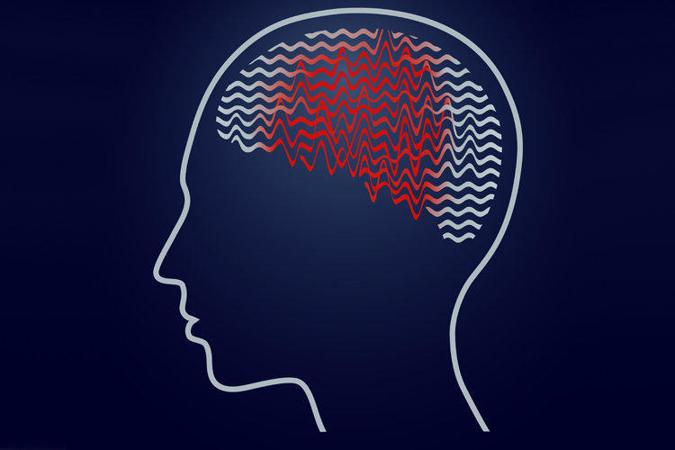 Alke'de Epilepsi için nasıl destekler sunuyoruz?